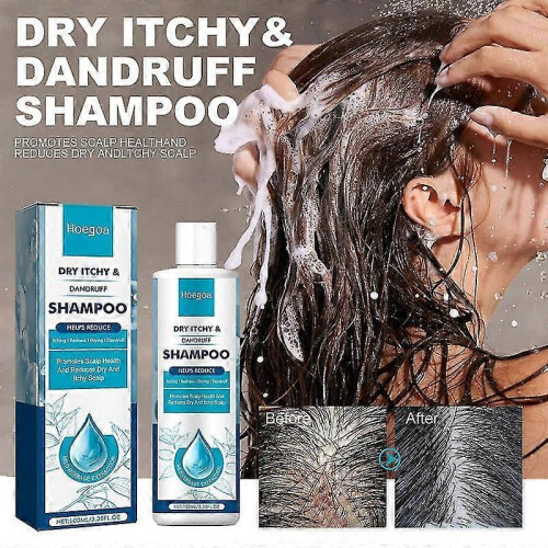 100ml Psoriasis Seborrheic Dermatitis Psoriasis Shampoo-scalp 1