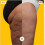 (Tudor Gold) Solielab Cellulite Machine, Cellubye - Electric Cellulite Suction 5
