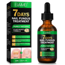 (1PC) 1/2/3PCS Nail Fungus Treatment, Ginger Nail Fungus Treatment, Toenail Cuticle Care Oil Care, Fungal Nail Treatment, 7 Days Nail Fungus Treatment