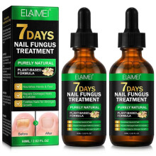 (2PCS)1/2/3PCS Nail Fungus Treatment, Ginger Nail Fungus Treatment, Toenail Cuticle Care Oil Care, Fungal Nail Treatment, 7 Days Nail Fungus Treatment