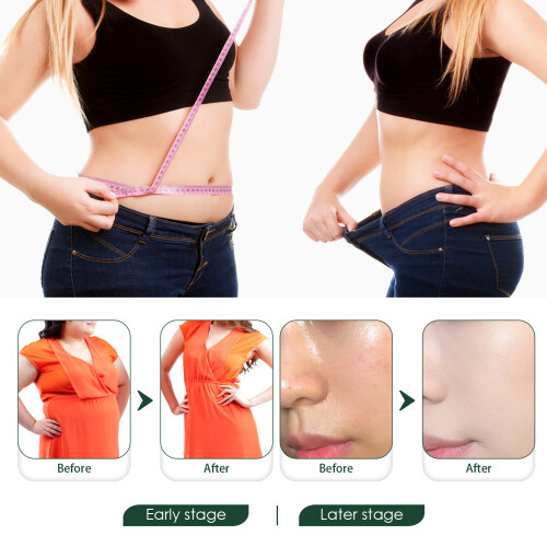 Sugar Belly Button Patch - Shape Body, Tighten Skin, Reduce Sugar Absorption, 30pcs 2