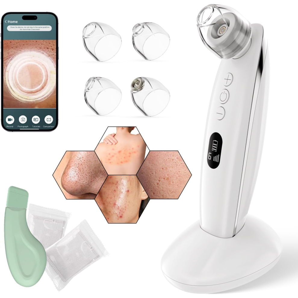 Chronus Blackhead Remover Vacuum Pore Extraction With Camera 6 Adjustable Modes(White)