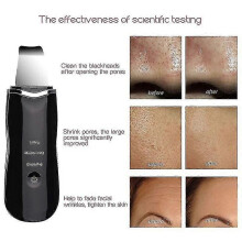 (white, One size) Ultrasonic Skin Scrubber Deep Peeling Shovel Facial Pore Cleaner Face Skin Scrubber |skin Scrubber