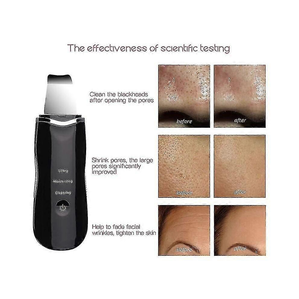 Kikidex White (, One Size) Ultrasonic Skin Scrubber Deep Peeling Shovel Facial Pore Cleaner Face Skin Scrubber |Skin Scrubber