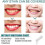 Celsky Smile Paint, Celsky Paint - Our Best Celsky Teeth Paint, Celsky Teeth 4