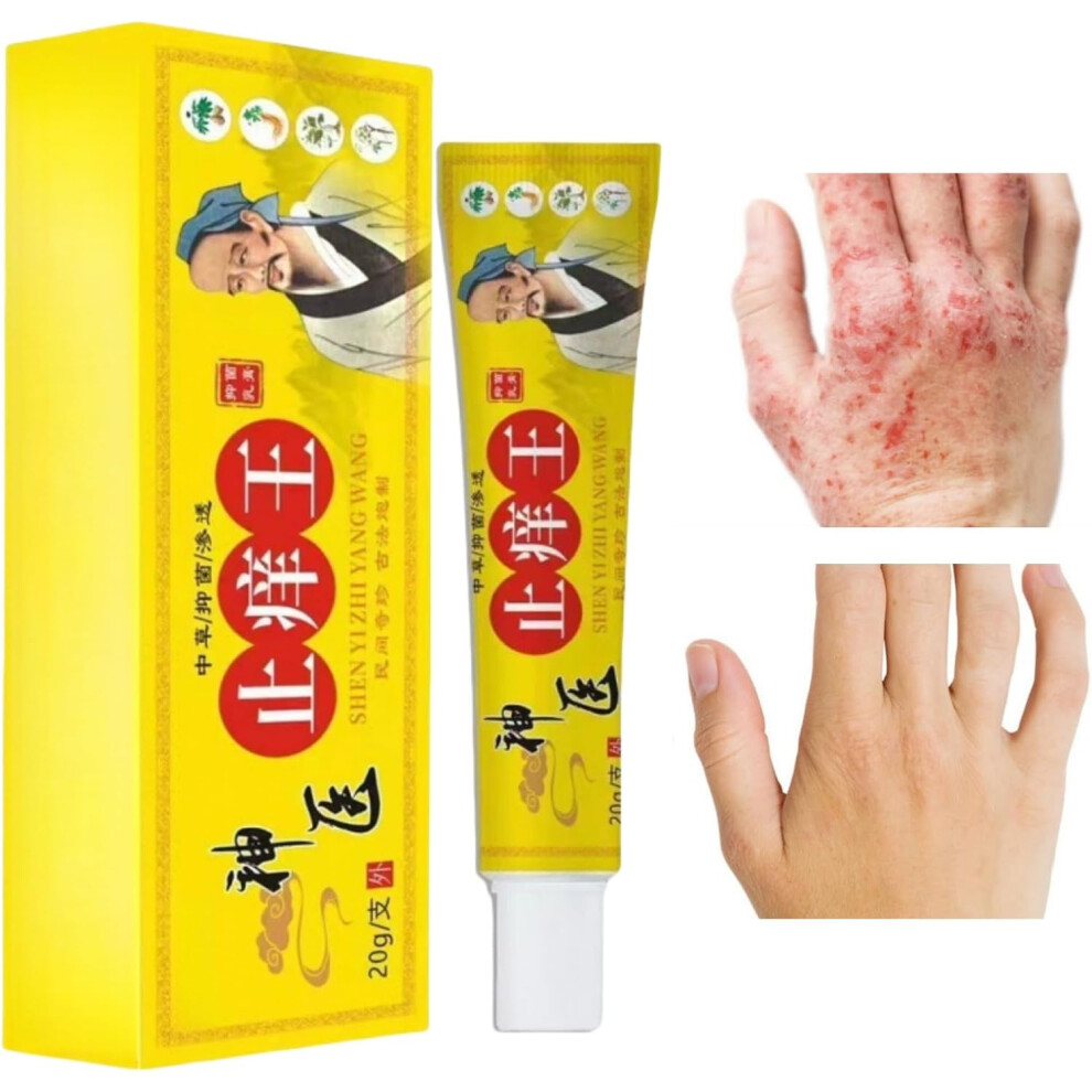 Gogerstar Cream (10Pcs) Face ,Chinese ,Herbal Body ,Anti-Itch ,Body ,Antifungal Body For Itchy Skin,Moisturizing Skin