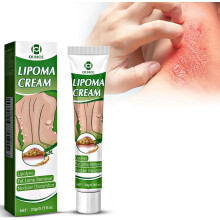 Antischimmelcrème 20 G, Antischimmelcrème Voor De Huid, Verlicht Schimmelinfecties In De Lies, Ringworm, Eczeem