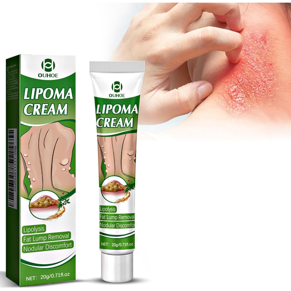 Gogerstar Cream Antifungal 20G, Antifungal Skin Relieves Jock Itch, Ringworm,Eczema,Effective Treatment For Tinea Pedis, Relieves Itching,Antifungal