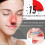 RespiRelief Red Light Nasal Therapy Instrument 2