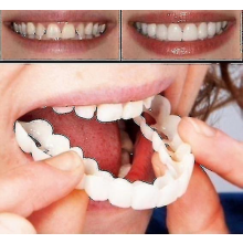 Um par de próteses dentárias superiores e inferiores de alta qualidade Instant Smile ComCompatiblet Fit Flex Cosmetic Teeth Dentes de prótes