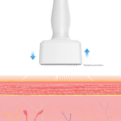 Derma Stamp Roller 140 Titanium Microneedle Adjustable 0-3mm Skin Care 2