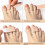 6Pcs Hammer Toe Straightener Tapes Toe Wraps 2