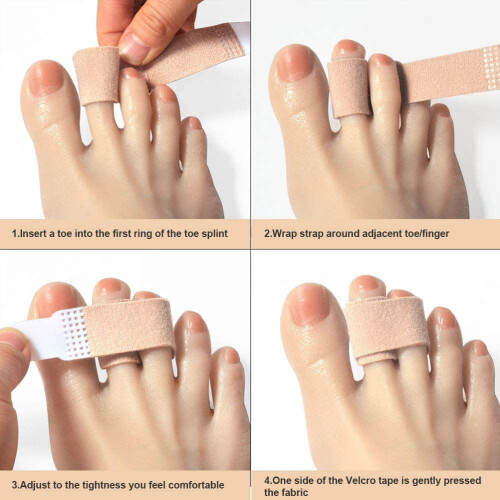 6Pcs Hammer Toe Straightener Tapes Toe Wraps 1