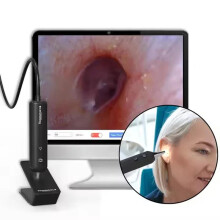 1280P HD Digital - Otoskop mit verstellbarem Licht & Computer - Dateiübertragung