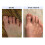 TIPS Toe Nail Conditioner 2 csomag 3