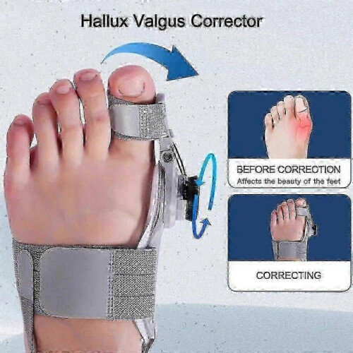 (grey) Treatmedy Bunion Fix Toe Valgus Corrector 2024 1