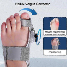 (black) Treatmedy Bunion Fix Toe Valgus Corrector 2024