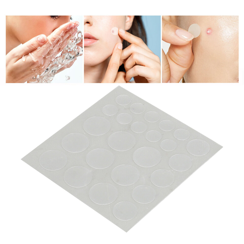 216Pcs Pimple Pads Covering Isolating Healing Portable Easy to Use Hydrocolloid Pimple Patch for Home Travel