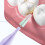 Purple Interdental Brushes 40pcs 1.2-1.5mm 6