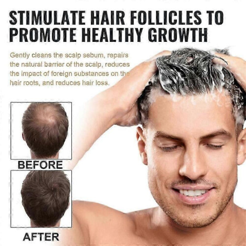 (5pcs)1/3/5x Spartan Shampoo, Spartan Root Activator Shampoo, Mane Root Activator Shampoo 2