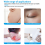 Silicone Sheets for Scars for Wrinkles Suitable for Scars 3