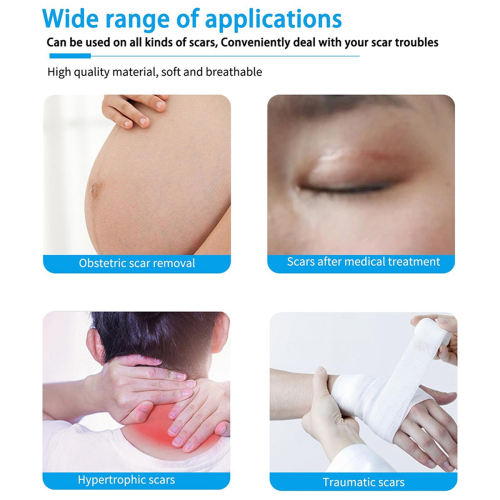 Silicone Sheets for Scars for Wrinkles Suitable for Scars 2