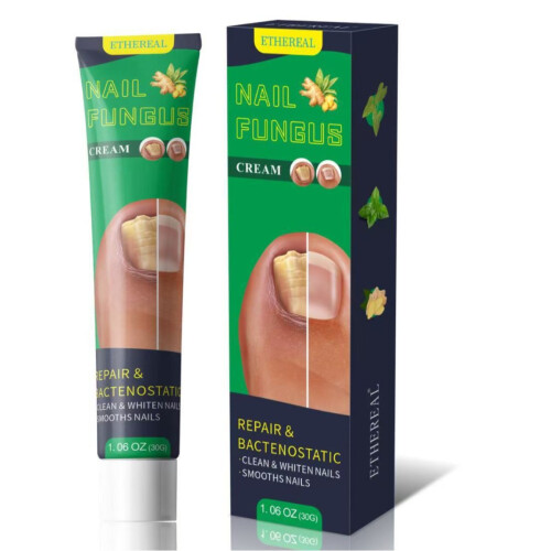 Ointment Onychomycosis Care Cream 2