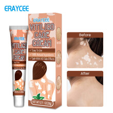 ERAYCEE White Bite Paste Sweat Spots And Spots Care