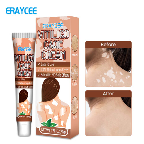 ERAYCEE White Bite Paste Sweat Spots And Spots Care