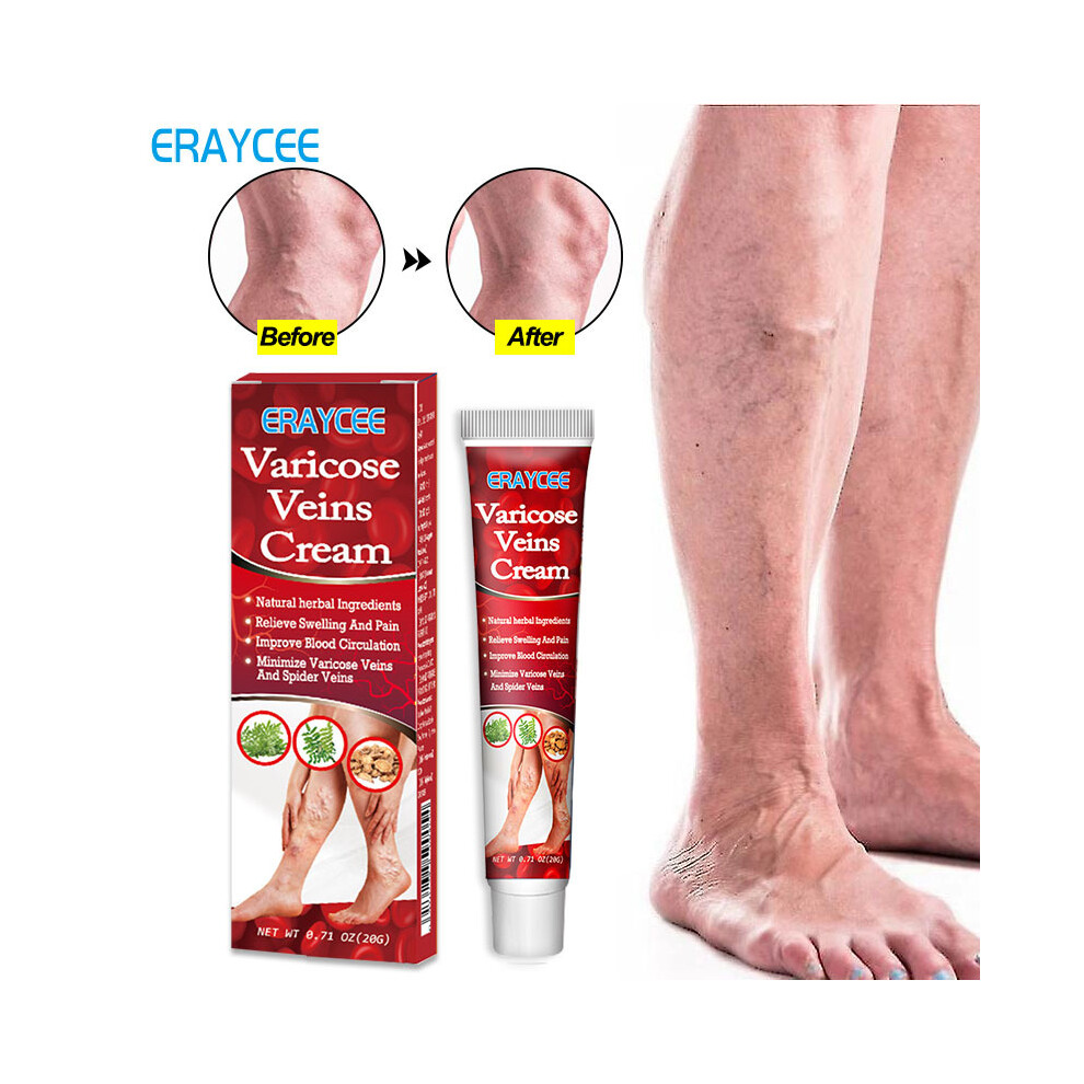 Skesrjtop (20G) Herbal Intestine Ointment Maikang Ointment Mailishu Soft Ointment Maichuan Ointment