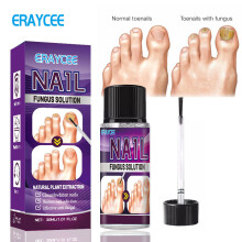 Plant Ash Armor Liquid Concave Thickening Type Onychomycosis Soft Nail Hand And Foot Repair Liquid