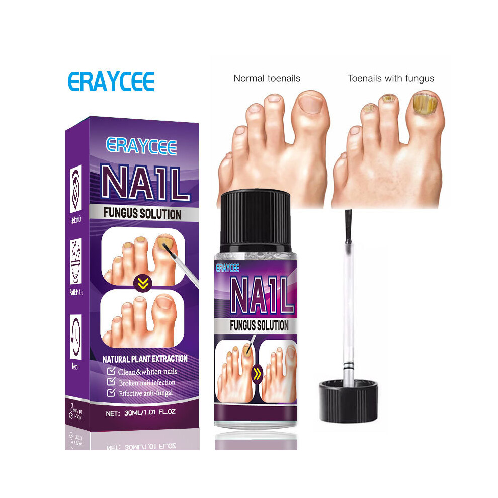Skesrjtop Plant Ash Armor Liquid Concave Thickening Type Onychomycosis Soft Nail Hand And Foot Repair Liquid
