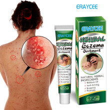 Plant Extract Skin Fresh And Clean Care Topical Cream For Skin Itching