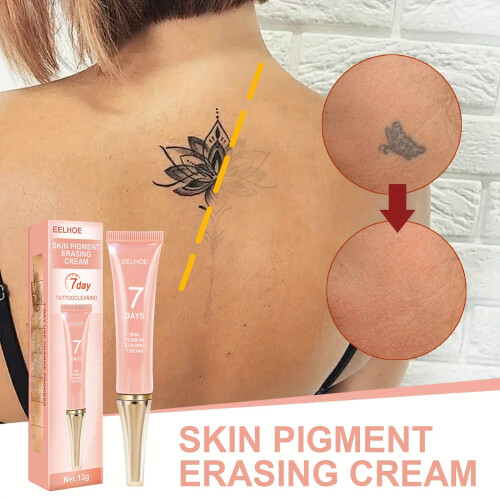 Permanent Tattoo Removal Cream - Fast and Effective Moisturizing Formula for Removing Ink Permanently 1
