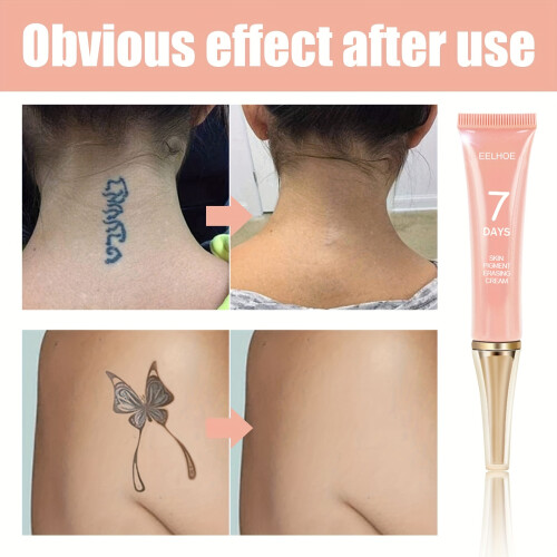 Permanent Tattoo Removal Cream - Fast and Effective Moisturizing Formula for Removing Ink Permanently 2