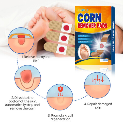 Corn Patch Mais Salbe Fleisch Kallus Fußpflege Mais Salbe 1