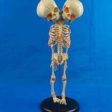 (As show, One size) Baby Deformed Head Skull Model with Base Human Skeleton Model for Laboratories Hospitals