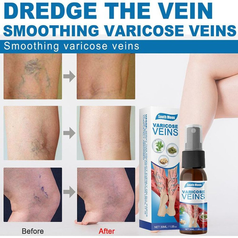 South Moon Legs Spray Smoothes Legs Bulges Smooth Earthworm Legs Active Massage Spray