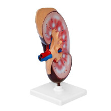 (As show, One size) Human Body Kidney Anatomical Model, Educational Tool Teaching Aids, School Learning Tool, Kidney Structure Model