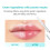 Dr.Melaxin, Bio-Spicule Plumping Lip Shot, Mild Soft Touch, 0.13 fl oz (4 ml) 3