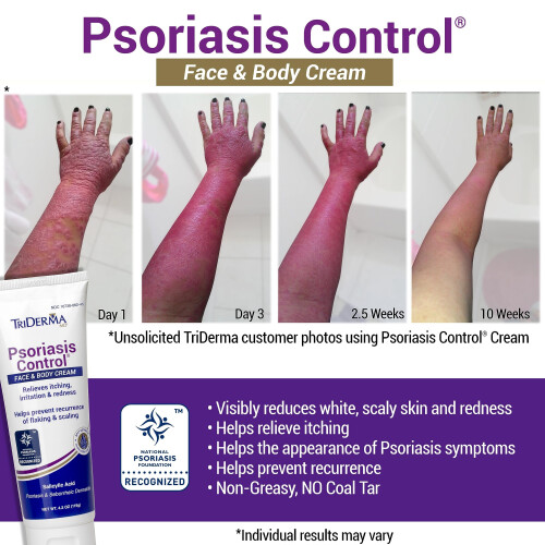 Creme facial e corporal TriDerma Psorase Control 4,2 onas 1