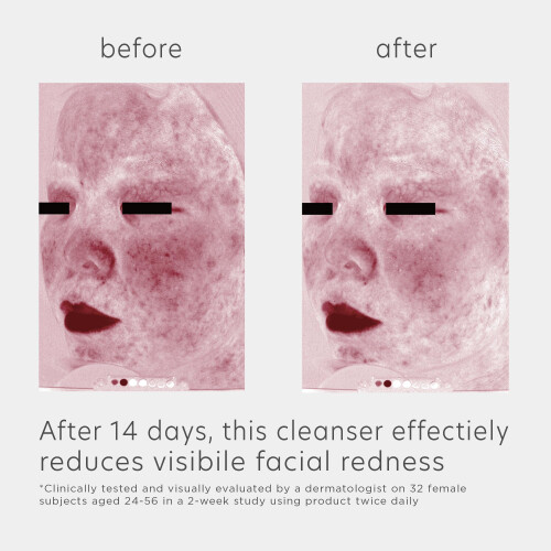 EltaMD Eltamd Skin Recovel 2
