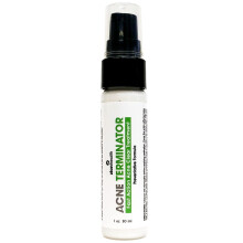 Zion Health, Akne-Terminator, 1 fl oz (30 ml)