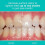 Opalescence Opalescence Whitening Demorypaste - Pack de 6 - Fluorure Oral Soins - 4,7 oz - Mint cool - TP-5166-6 2