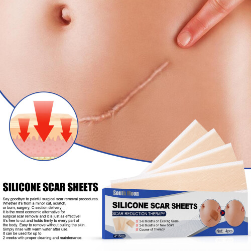 4 Stk Narben-Silikonband 1,6  5,9 Zoll transparent 2