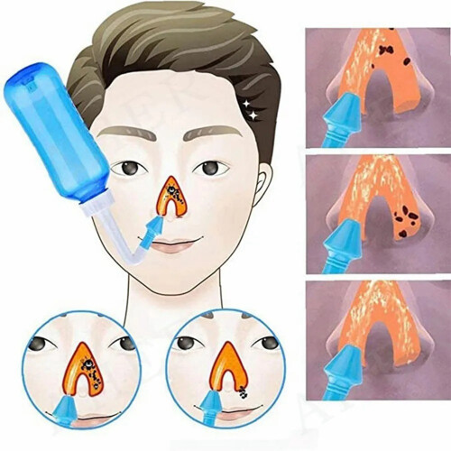 Nasenspülflasche 300 ml 13,5  5,5 cm PP Weiß 2