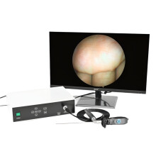 1080p Full HD Medisch Endoscoop Video Systeem met FHD Camera Hoofd