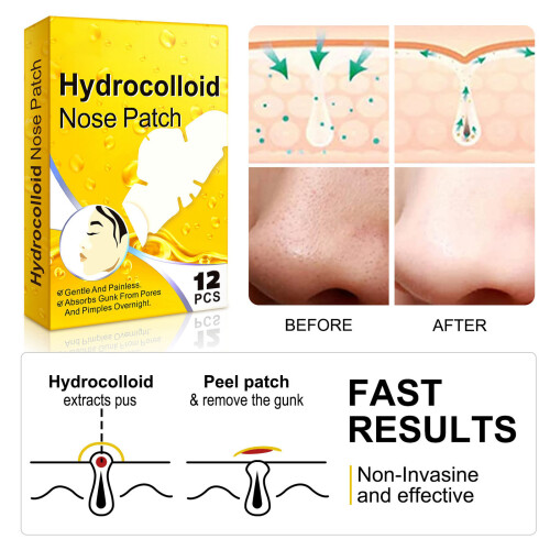 12 Stück Hydrocolloid Nasenpflaster Mitesserstreifen 2