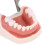 28 piezas removibles de dientes - kit de Typodont de plástico 10