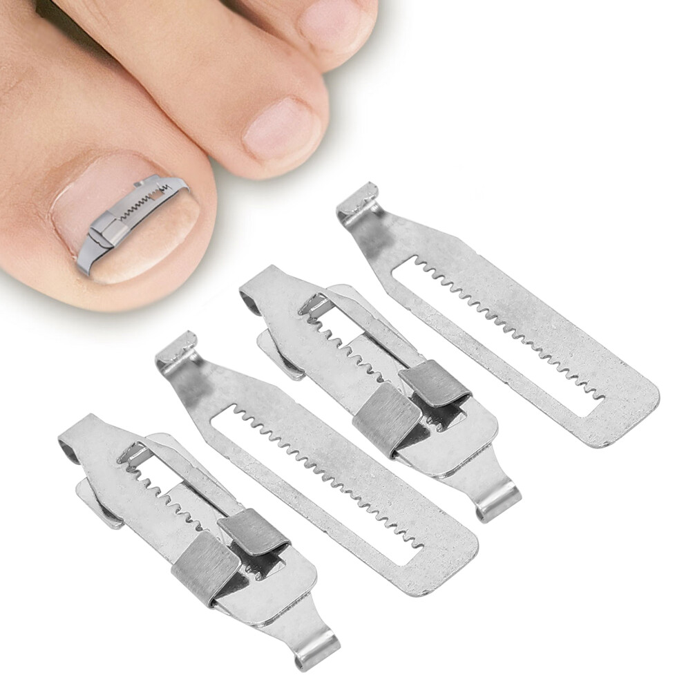 2PCS Ingrown Toenail Corrector Stainless Steel Paronychia Correction Tool for Toenail Correction